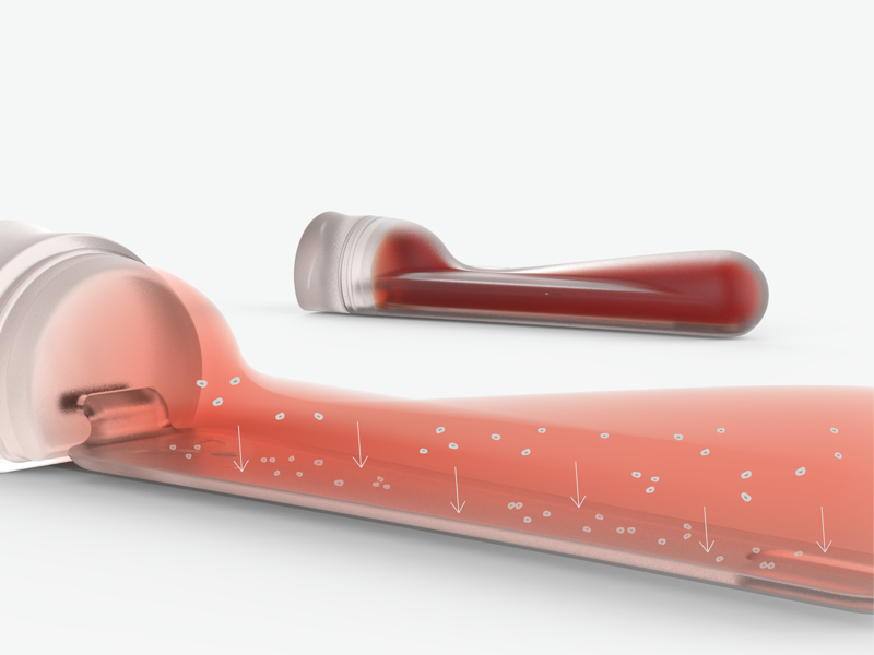 אור ונגרוביץ